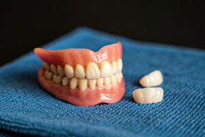 Dentures resting on a blue fabric with two loose teeth beside them.