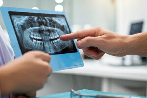 A person points to a dental X-ray image held by another individual, showing teeth and jaw structure.