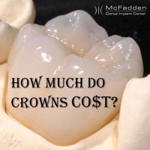 How much do crowns cost?