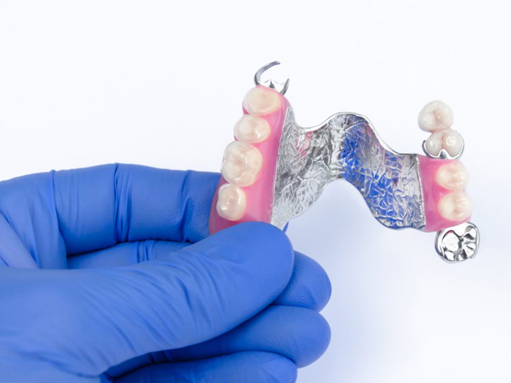 Upper Partial Dentures - Dental Implant Center