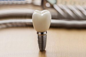 A dental implant with a tooth crown attached, standing upright on a wooden surface.