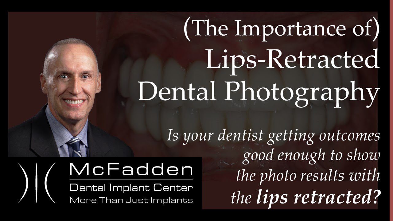 (The Importance of) Lips-Retracted Dental Photography - Dental Implant ...